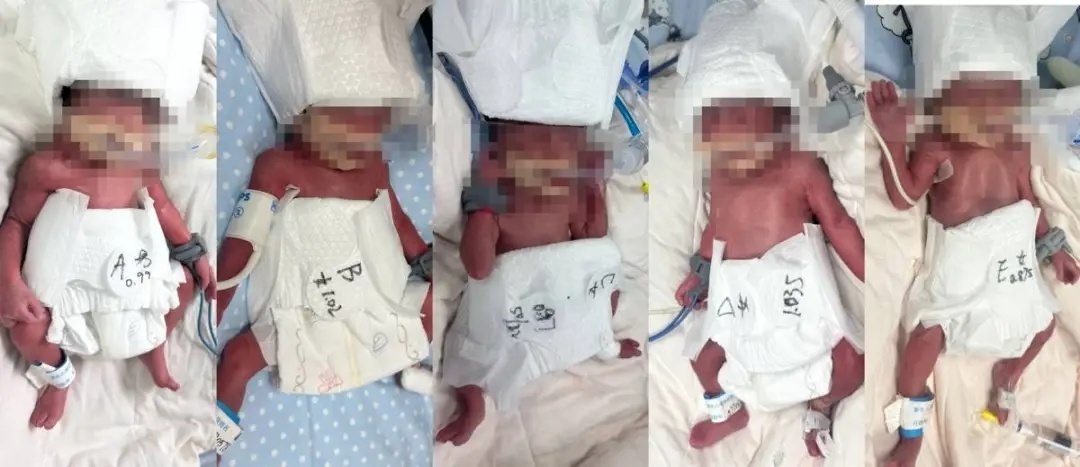 ئۇيغۇر ھامىلىدار بەش كېزەك تۇغدى ئۇيغۇر ھامىلىدار بەش كېزەك تۇغدى