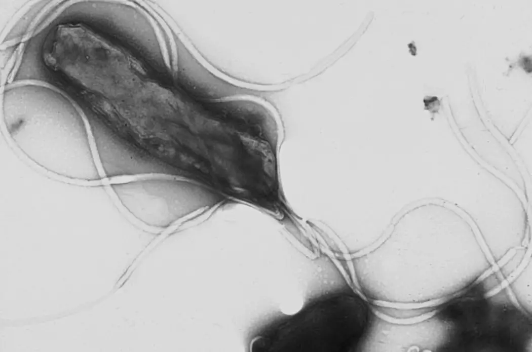 ئاشقازان چىقىش ئېغىزى بۇرمىسىمان تاياقچە باكتېرىيەسى دىگەن نىمە ئاشقازان چىقىش ئېغىزى بۇرمىسىمان تاياقچە باكتېرىيەسى دىگەن نىمە