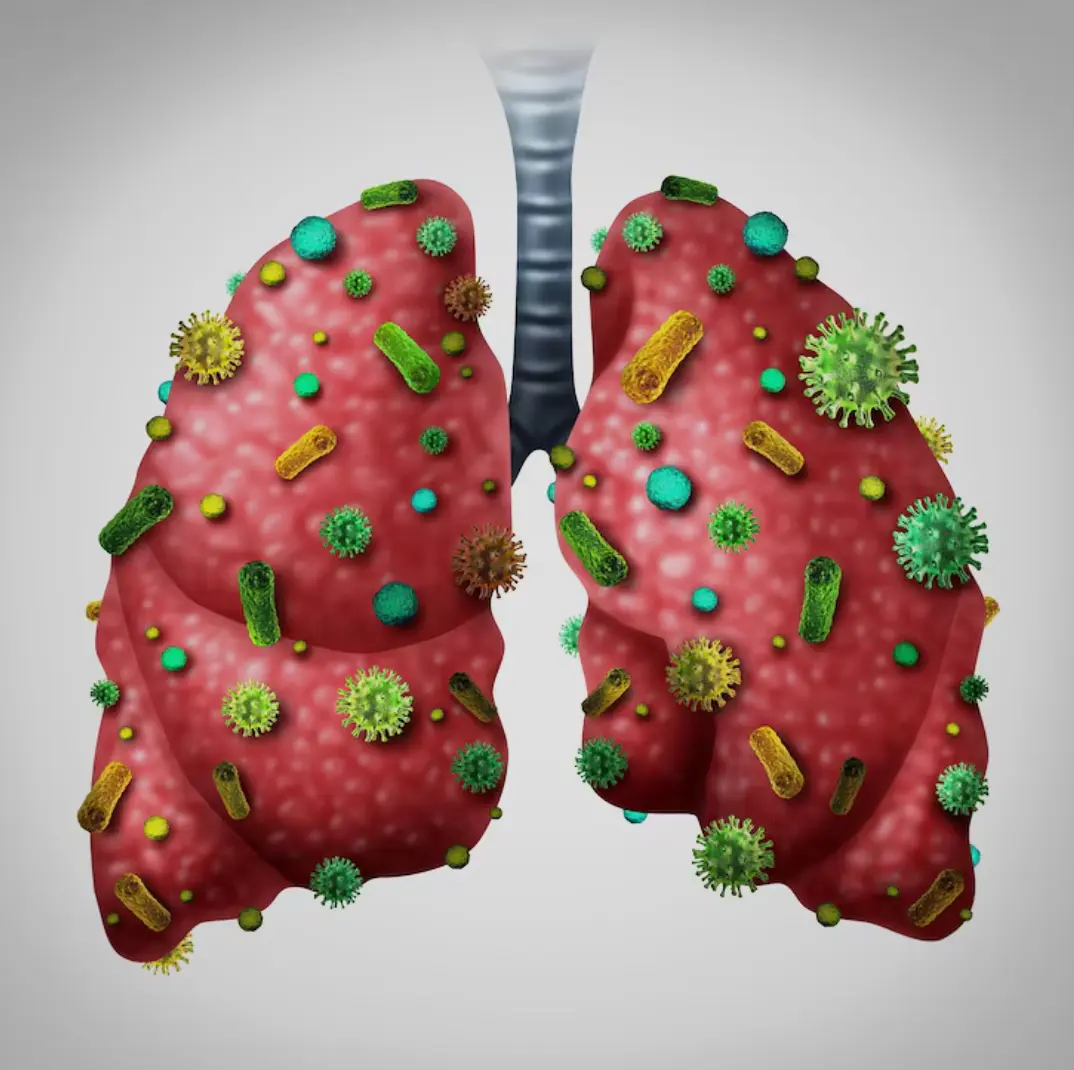 ئۆپكە تۇبېركۇليۇزىنىڭ ئالامەتلىرى ۋە تارقىلىش يوللىرىنى بىلىۋېلىڭ ئۆپكە تۇبېركۇليۇزىنىڭ ئالامەتلىرى ۋە تارقىلىش يوللىرىنى بىلىۋېلىڭ