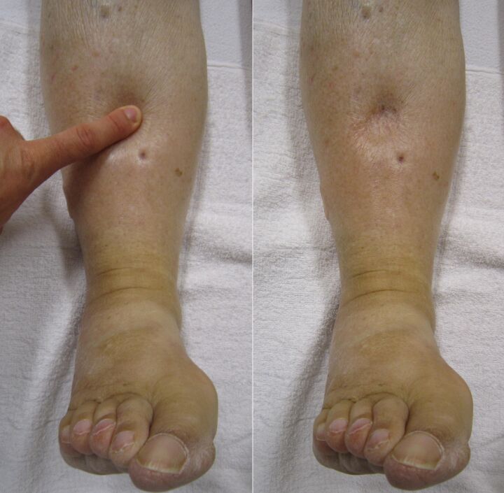 ئويمانلىشىدىغان سۇلۇق ئىششىق