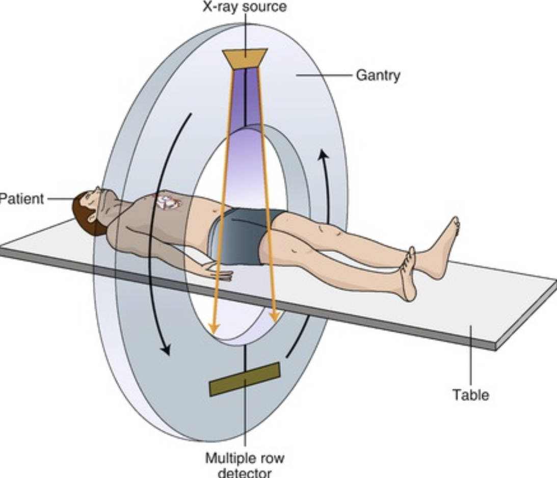 ct تارتىش پرىنسىپى ، بەدەننى تىلىم تىلىم ھالدا رەسىم تارتىدۇ