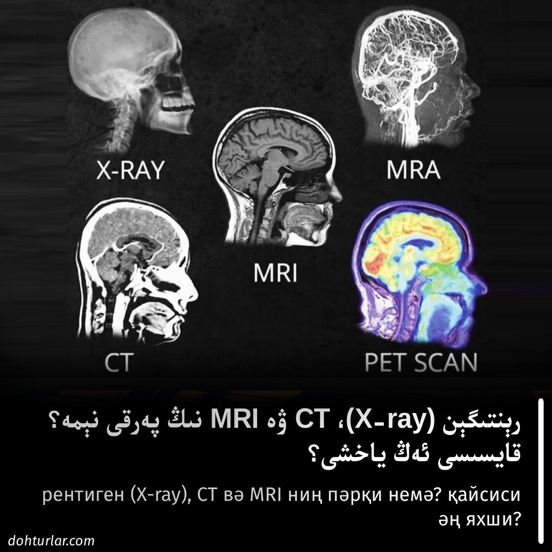 رېنتىگېن (X-ray)، CT ۋە MRI نىڭ پەرقى نېمە؟ قايسىسى ئەڭ ياخشى؟ رېنتىگېن (X-ray)، CT ۋە MRI نىڭ پەرقى نېمە؟ قايسىسى ئەڭ ياخشى؟