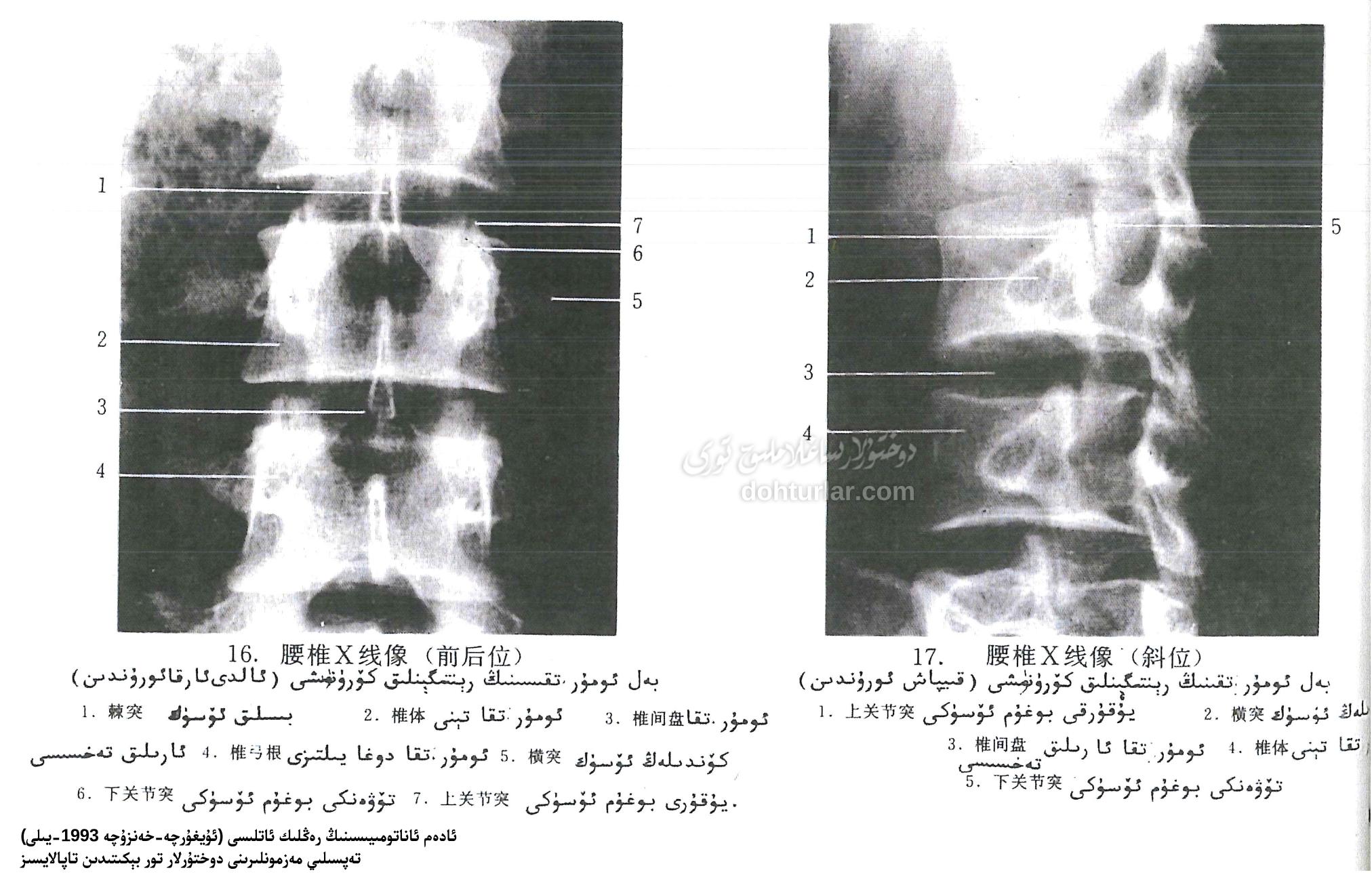 بەل ئومۇرتقىسىنىڭ رېنتىگېنلىق كۆرۈنۈشى