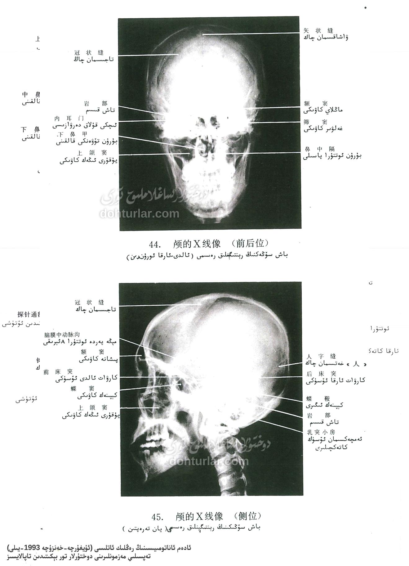 باش سۆڭىكىنىڭ رېنتىگېن X-ray كۆرۈنۈشى
