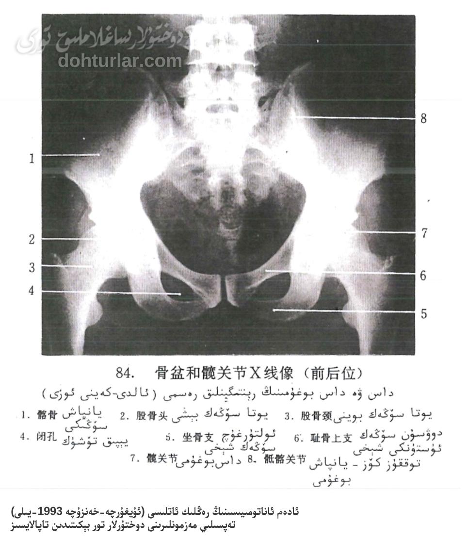 داس سۆڭىكى ۋە داس بوغۇمىنىڭ رېنتگېن كۆرۈنۈشى
