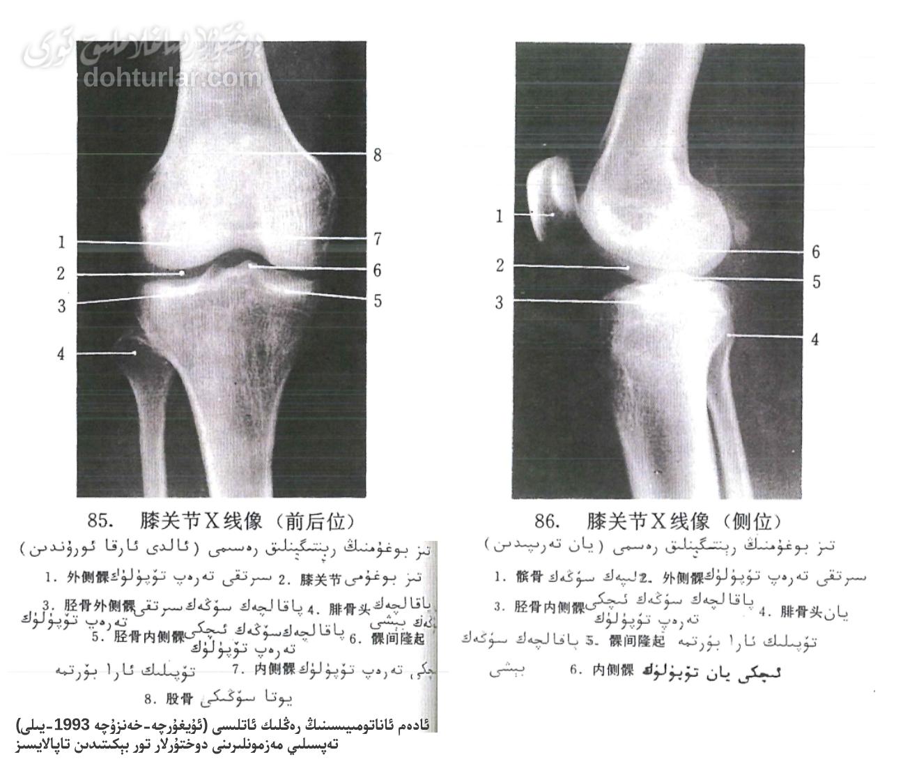 تىز بوغۇمى رېنتىگېنلىك ئاناتومىيەسى تىز بوغۇمى رېنتىگېنلىك ئاناتومىيەسى