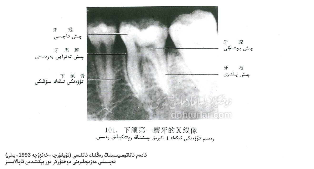 تۆۋەنكى ئېڭەك 1- ئېزىق چىشىنىڭ رېنتىگېنلىق رەسىمى