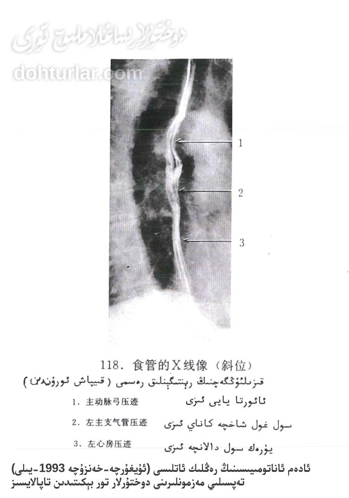 قىزىلئۆڭگەچ رېنتىگېن تەكشۈرۈشى