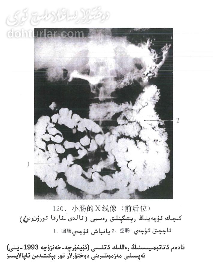 كىچىك ئۈچەي رېنتىگېنلىق كۆرۈنۈشى