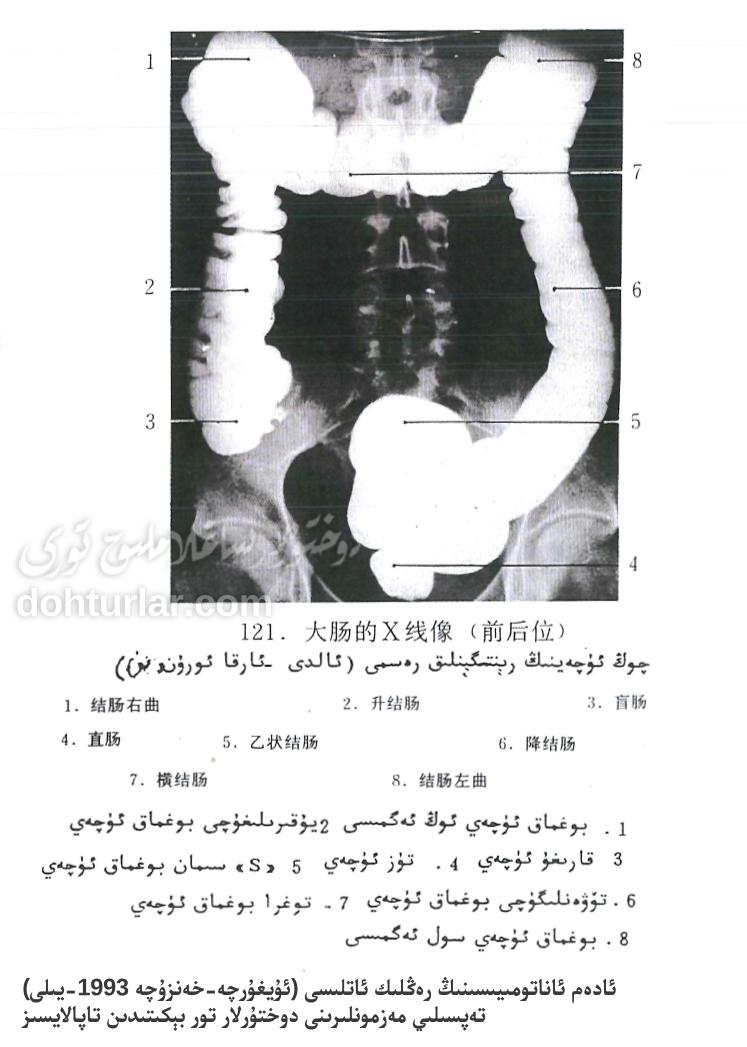 چوڭ ئۈچەي رېنتىگېنلىق كۆرۈنۈشى