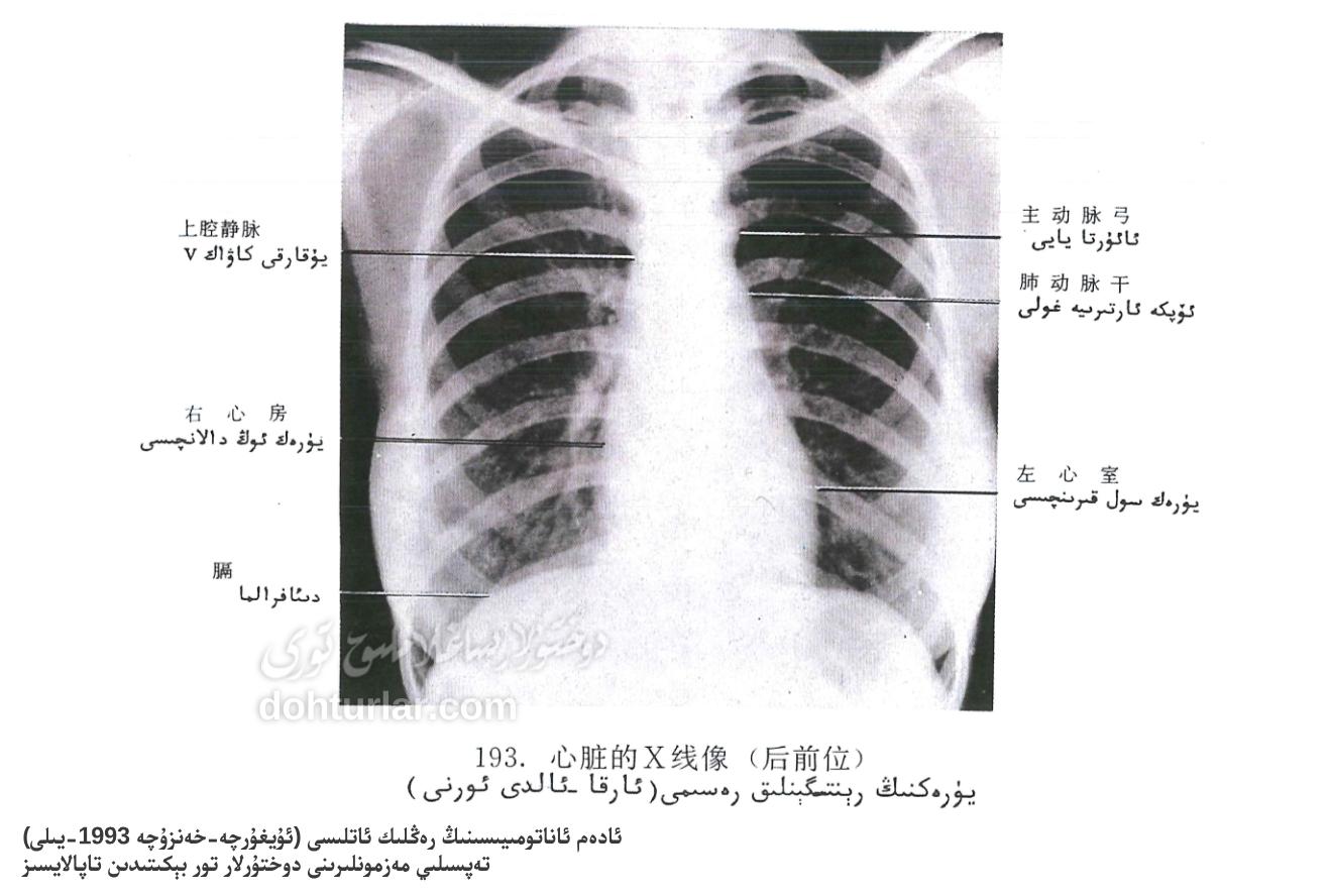 يۈرەكنىڭ رېنتىگېنلىق رەسىمى ئارقا ئالدى ئورنى