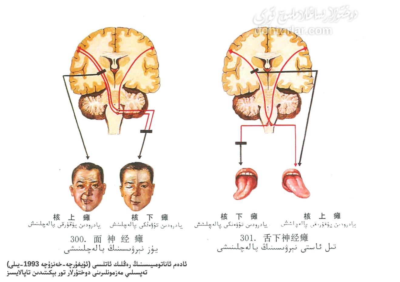 يۈز ۋە تىلدىكى پالەچلىك كۆرۈنۈشى يۈز ۋە تىلدىكى پالەچلىك كۆرۈنۈشى