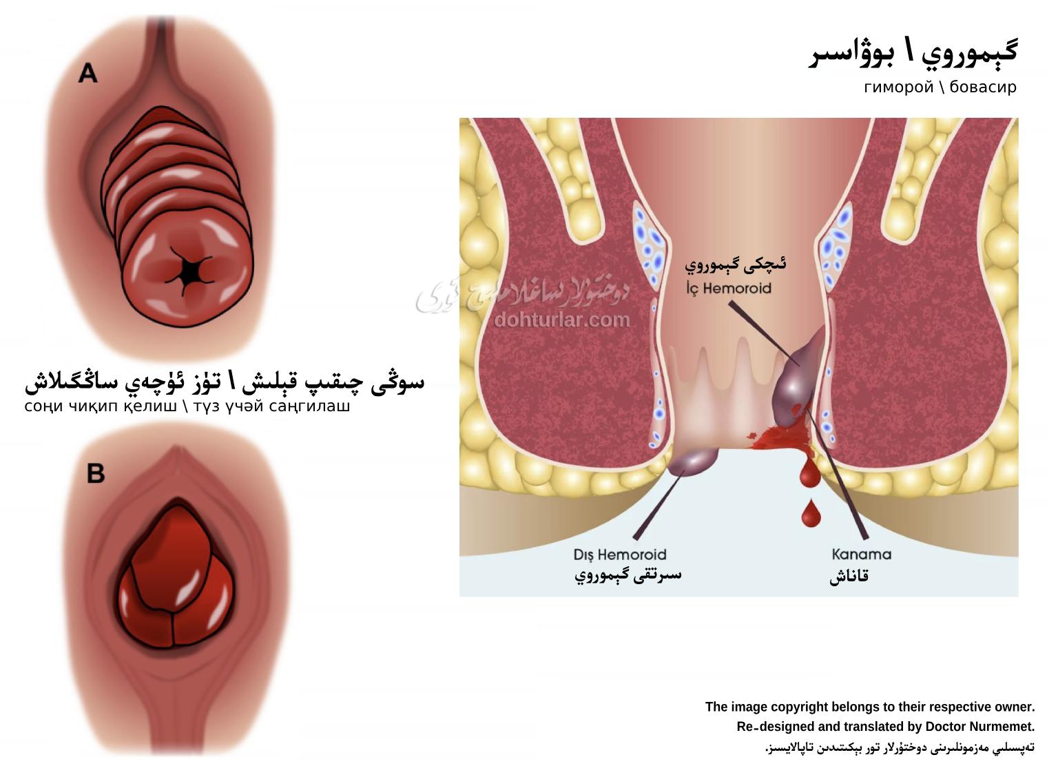 گېموروي بىلەن سوڭى چىقىپ قېلىشنىڭ پەرقى گېموروي بىلەن سوڭى چىقىپ قېلىشنىڭ پەرقى